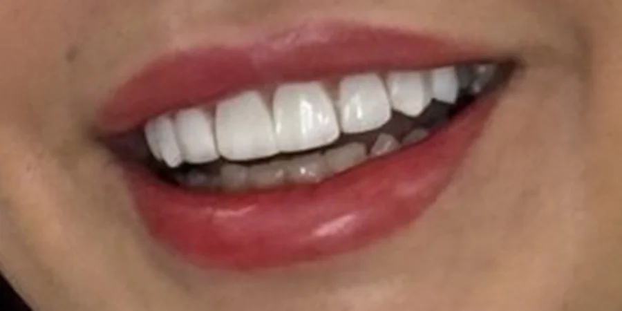 کامپوزیت ونیر در اصفهان